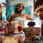 Newsweek: Rojava'da kimyasal silah kullanımı belgelendi